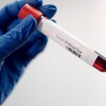 Medical professional holding Covid-19 blood test sample in laboratory, highlighting healthcare research.