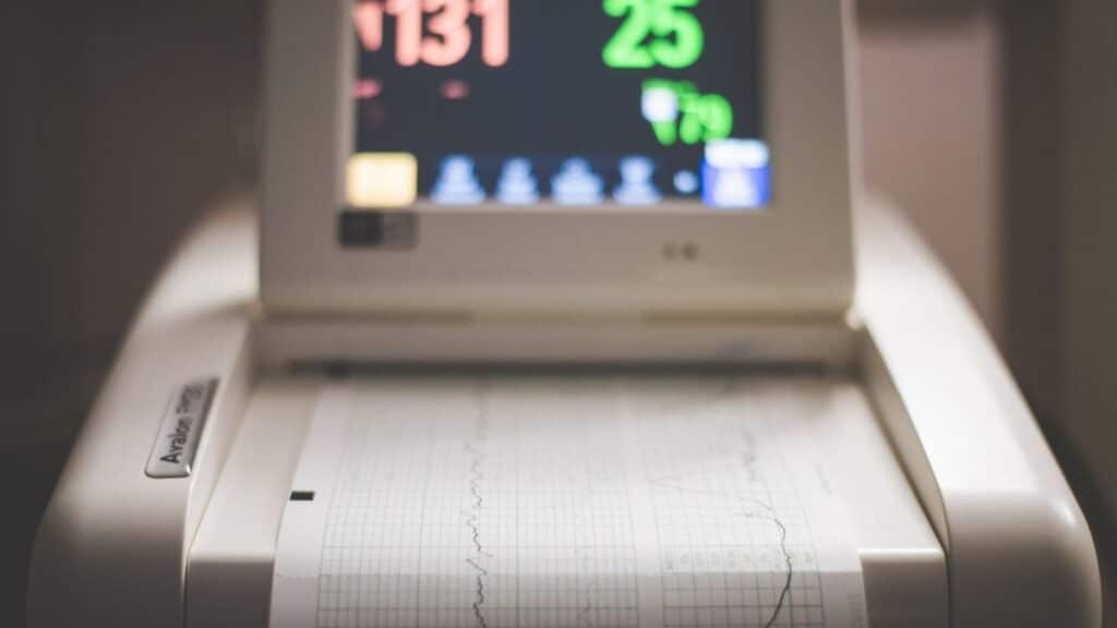 Detailed image of an electronic fetal monitoring machine showing heart rate and contraction data.