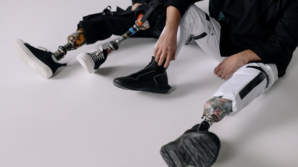 Stylish individuals showcasing prosthetic legs in a modern indoor setting.