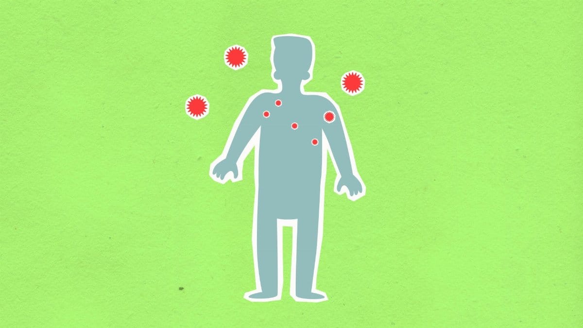 Paper cutout of male silhouette surrounded with many spreading contagious red viruses on green background during dangerous coronavirus disease outbreak