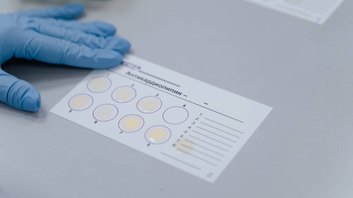 Lab test result form with gloved hand, indicating a scientific experiment setup.