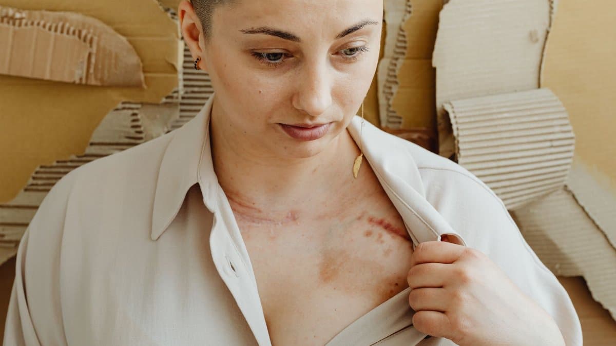 A woman showing a scar on her chest, emphasizing health and recovery themes.