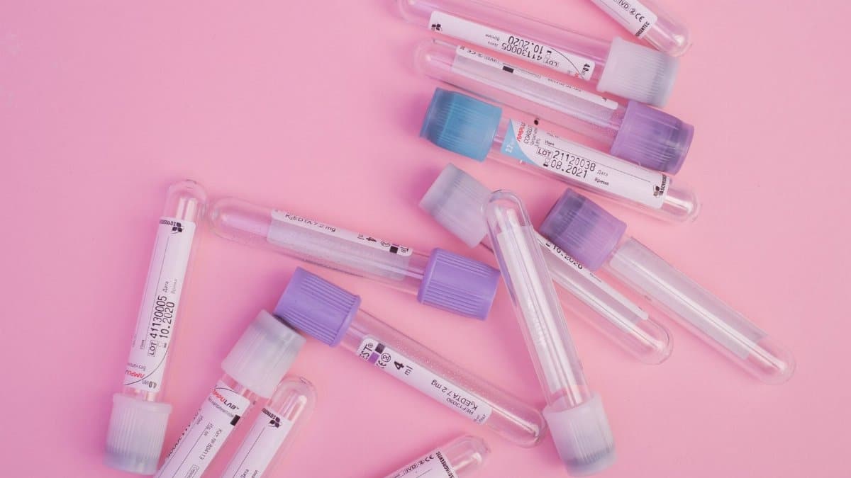 Top view collection of blood test tubes with stickers and colorful caps scattered on pink background