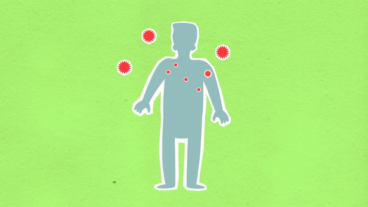Paper cutout of male silhouette surrounded with many spreading contagious red viruses on green background during dangerous coronavirus disease outbreak