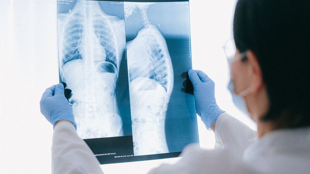 Medical professional analyzing chest x-ray images in a clinical setting for diagnostic purposes.
