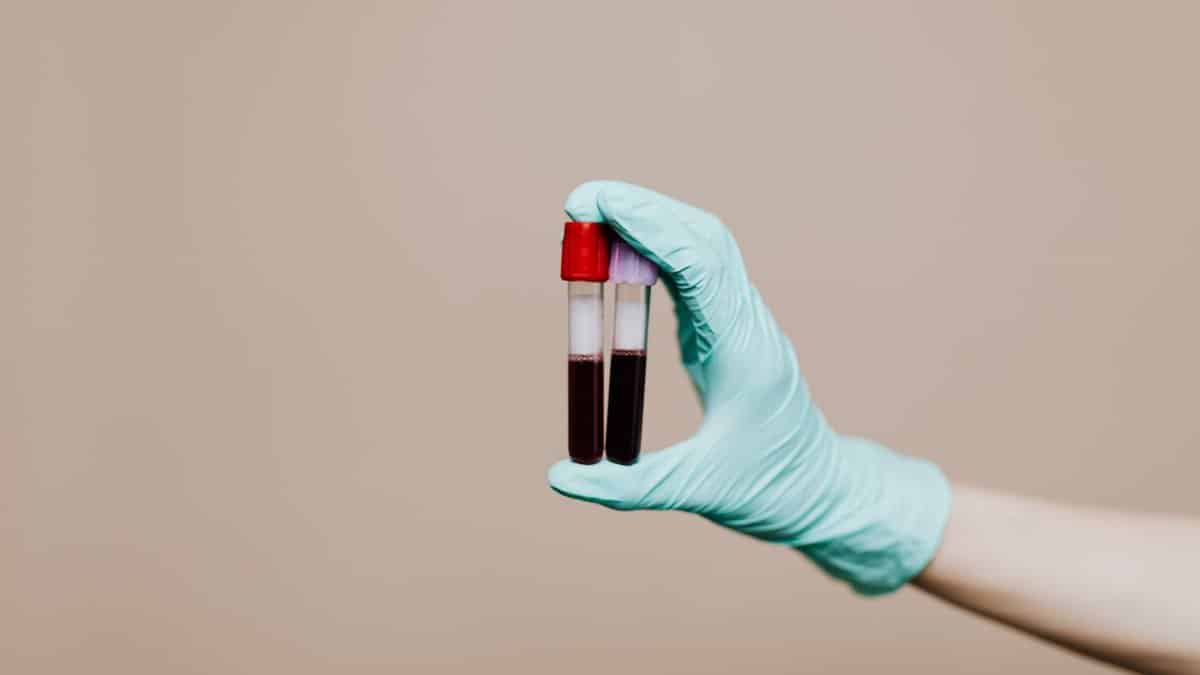 Close-up of a gloved hand holding two blood sample tubes in a laboratory setting.
