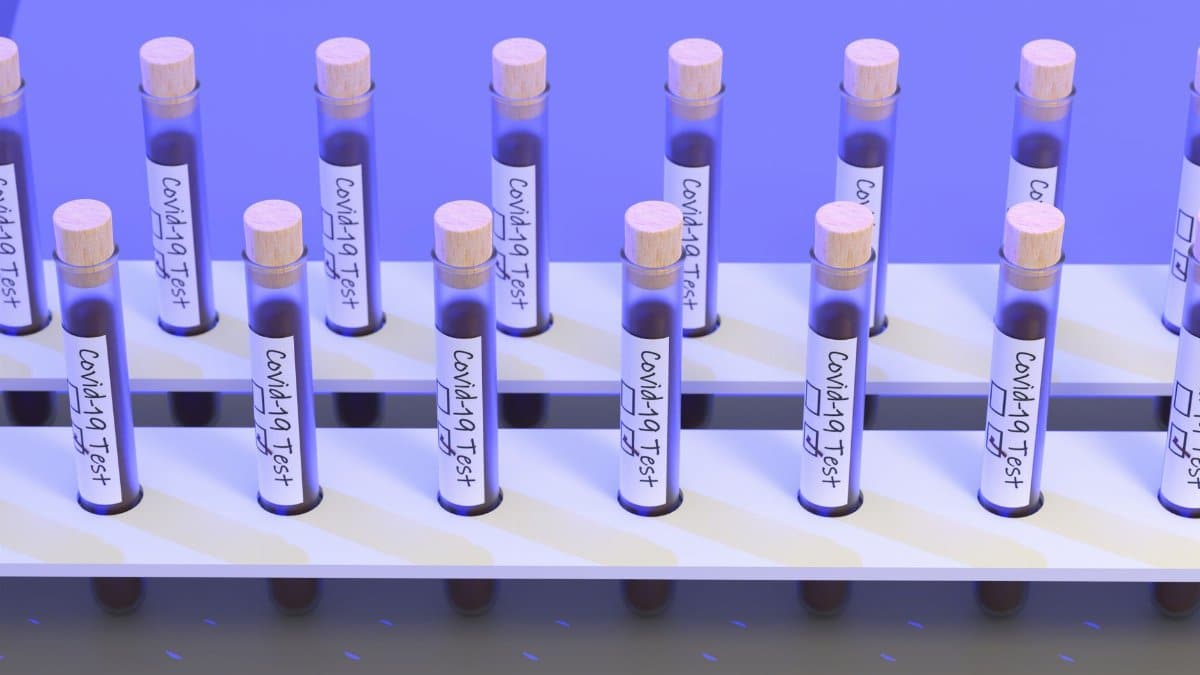 A set of COVID-19 test tubes in a rack, symbolizing medical research and diagnostics.