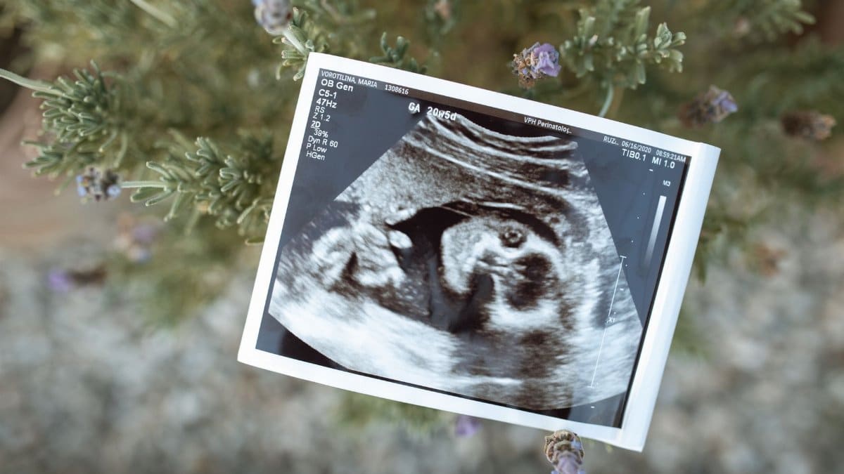 Close-up of an ultrasound image placed on a natural background, symbolizing new life.